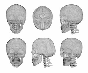 10325996-skull-and-cervical-vertebrae